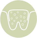 icon of Bone Grafting
